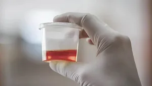 خون در ادرار همیشه خطرناک است؟